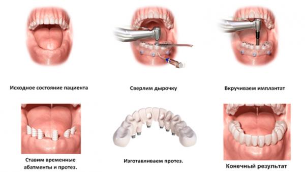 Кликните, чтобы открыть прикрепленное изображение
