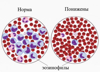 Особенности проведения анализа крови