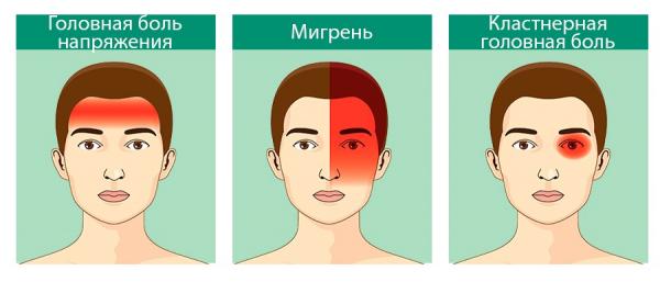 Лечение головной боли: советы и методы облегчения симптомов