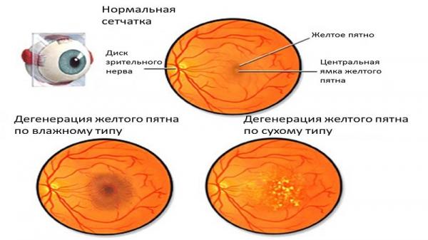 Кликните, чтобы открыть прикрепленное изображение