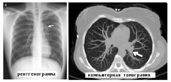 Кликните, чтобы открыть прикрепленное изображение