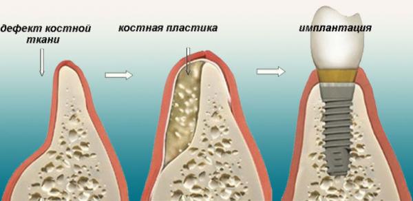 Кликните, чтобы открыть прикрепленное изображение