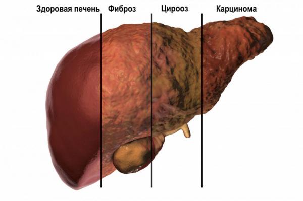 Кто в группе риска заболевания гепатитом с