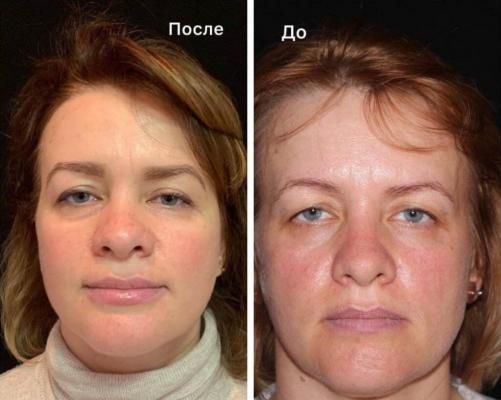 Пластика Век: Преобразование Искусства и Эстетики