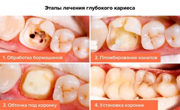 Кликните, чтобы открыть прикрепленное изображение